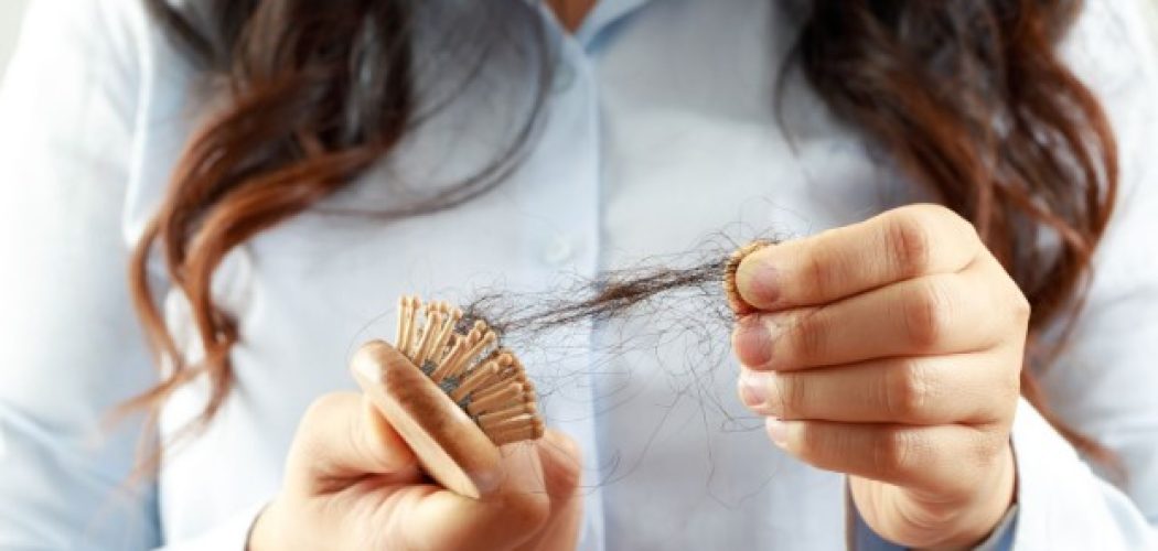 How To Prevent Hair Loss Naturally?
