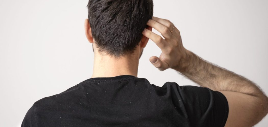 medium-shot-man-with-dandruff-problems-back-view