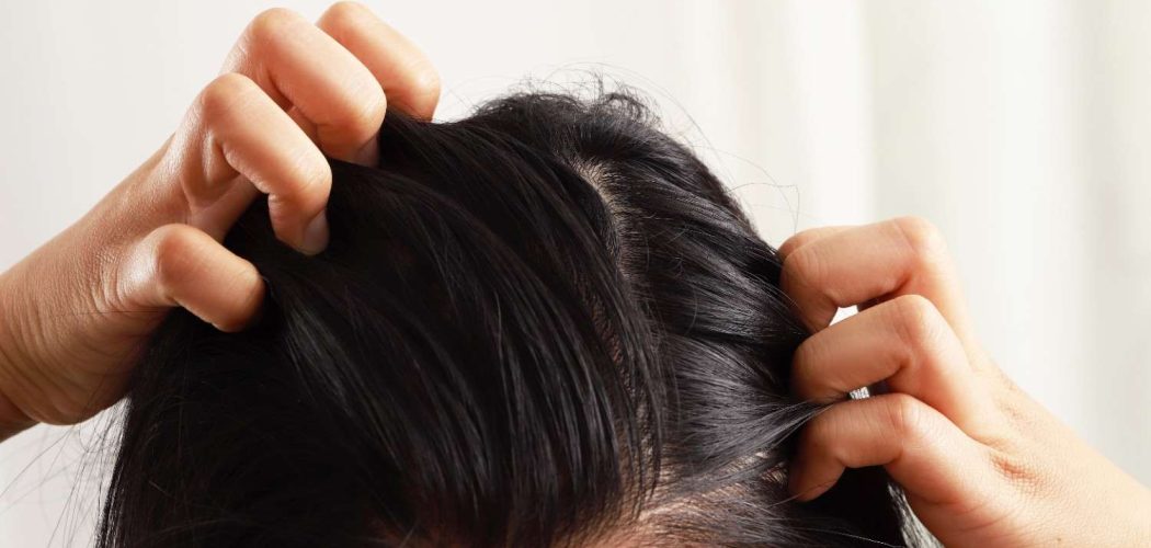 woman-has-itchy-scalp-oily-hair-hair-loss (1)