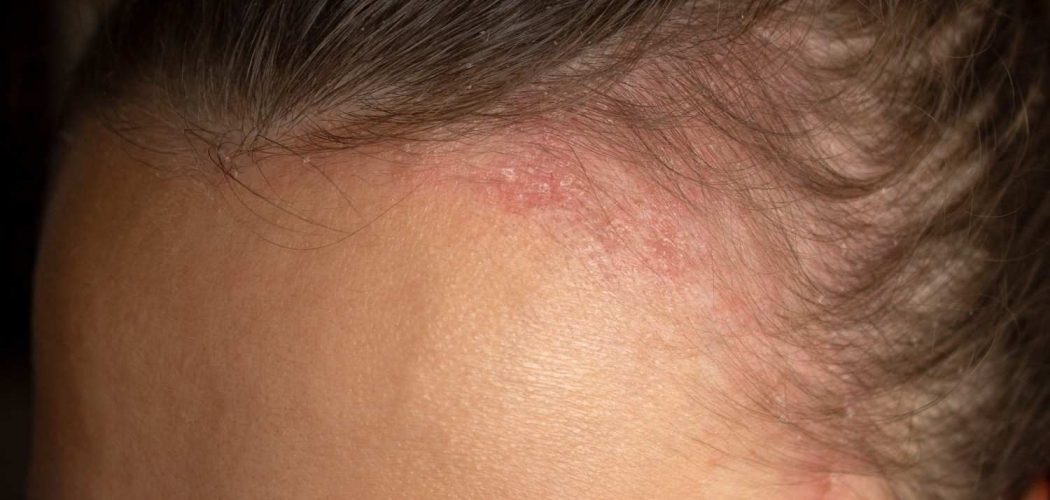 woman-with-bump-her-forehead (1)