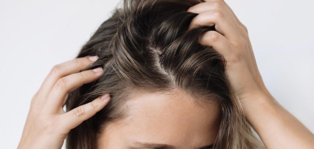 young-woman-with-dirty-greasy-hair-problem-oily-scalp-itching-head2